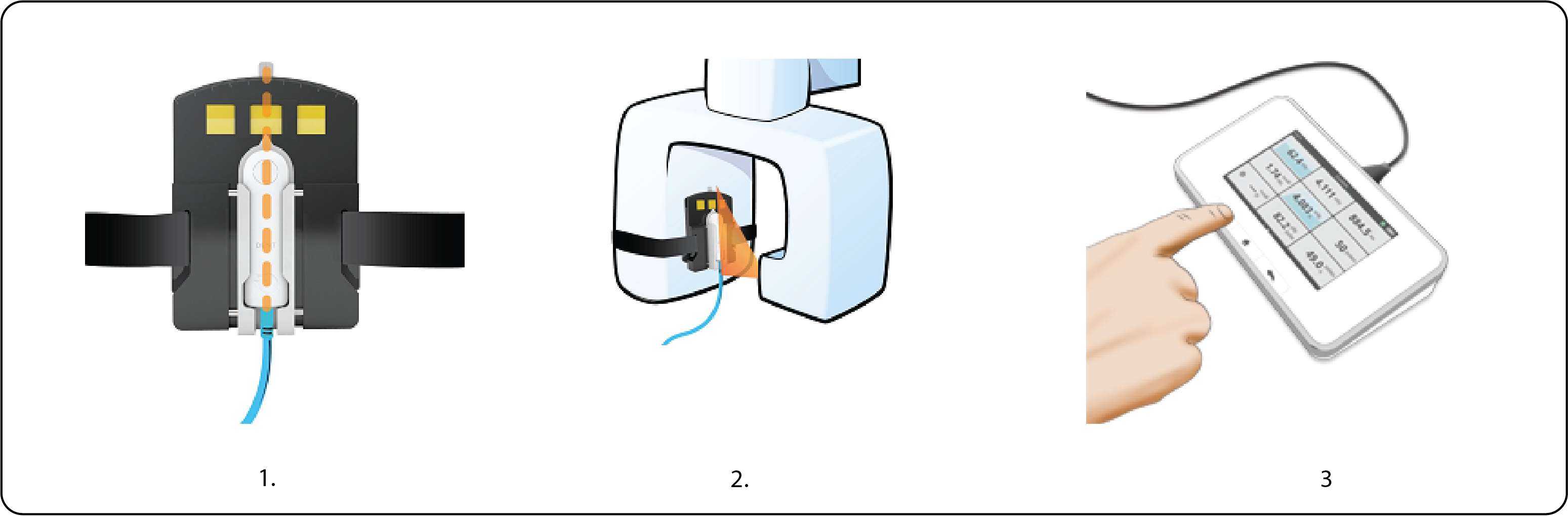 Measure dental