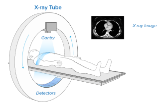 CT Imaging